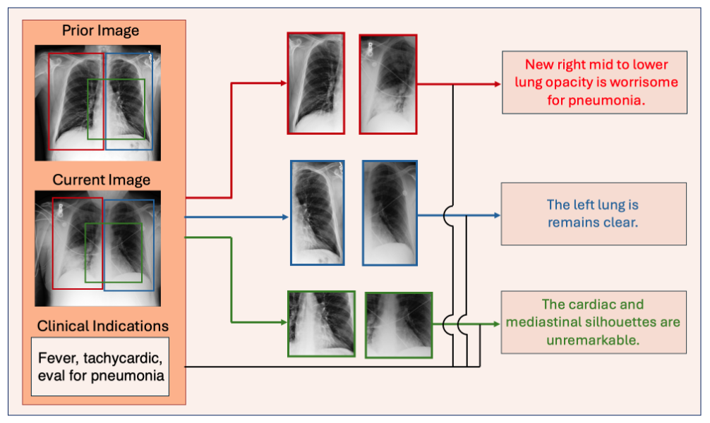 An overview of the STAR3 architecture for fine-grained radiology report generation, combining images with textual information to generate reports.